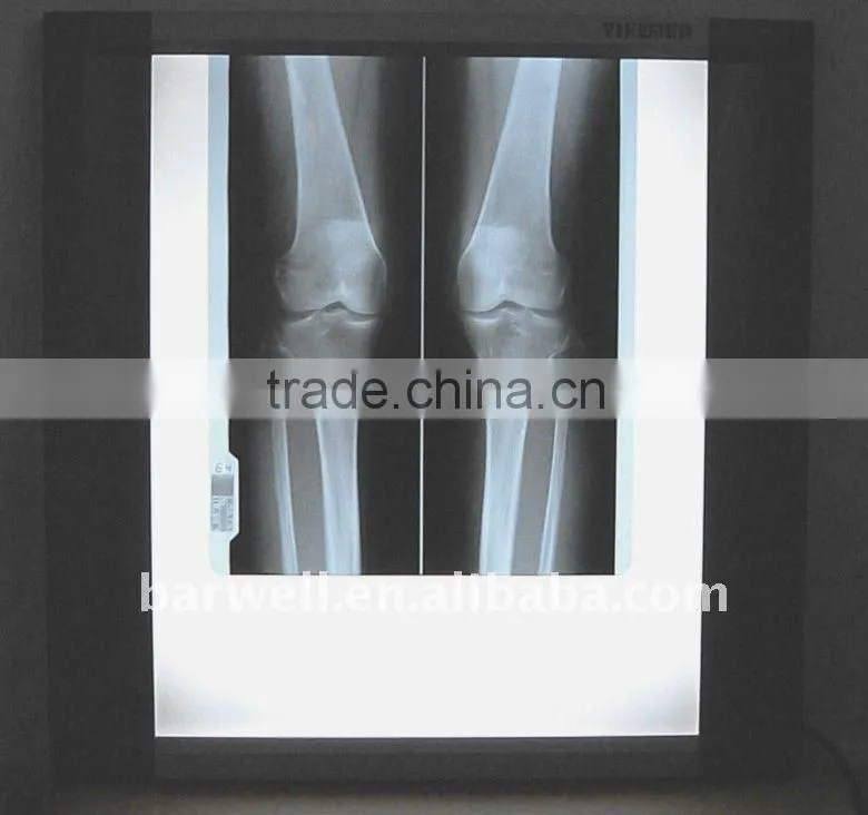 X ray film viewer for hospital useful