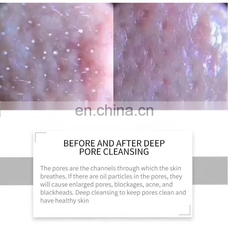 Hydrogen Oxygen Small Bubble Machine 6 IN 1/7 IN 1Rejuvenating Blackhead Removal Instrument Deep Cleaning Beauty Equipment