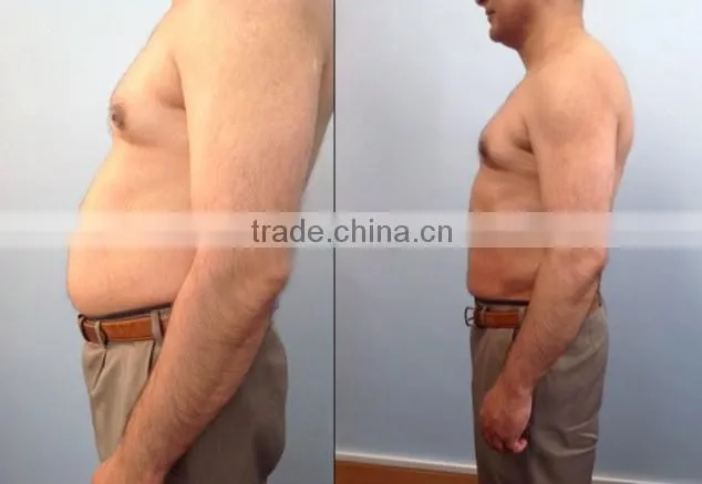 ultrasonic liposuction cavitation slimming machine for sale
