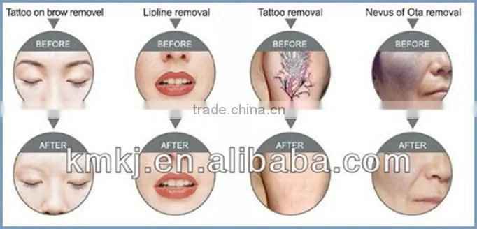 Professional 5 in1 beauty salon equipment for sale
