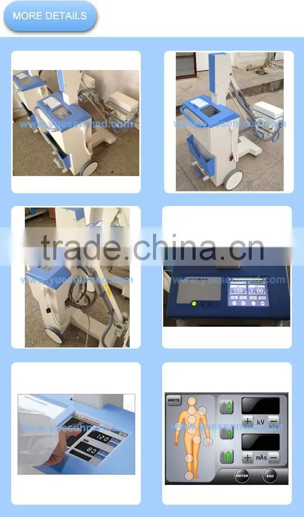 Medical 5KW high frequency mobile x-ray