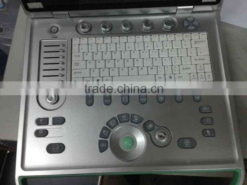 MSLPU25A HOT SALES Digital best Medical portable china portable ultrasound machine price