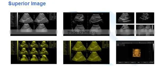Light weight PC platform 10.4 inch Laptop Ultrasound Scanner with 3.5Mhz Convex probe multi-frequency