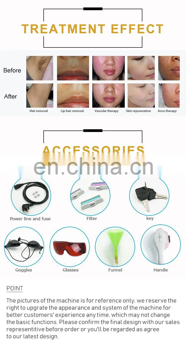 CE approved multifunctional portable elight/ipl hair removal with competitive price