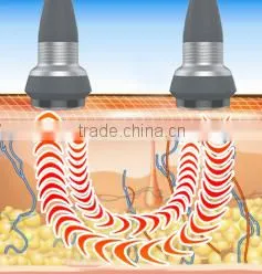Hot!Suslaser Fast Radio Frequency System Cavitation Cellulite Slimming System For Home Use