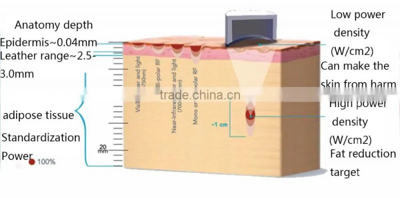 Micro machine liposonix hifu fat reduction 2016 new lipo slimming machine in alibaba