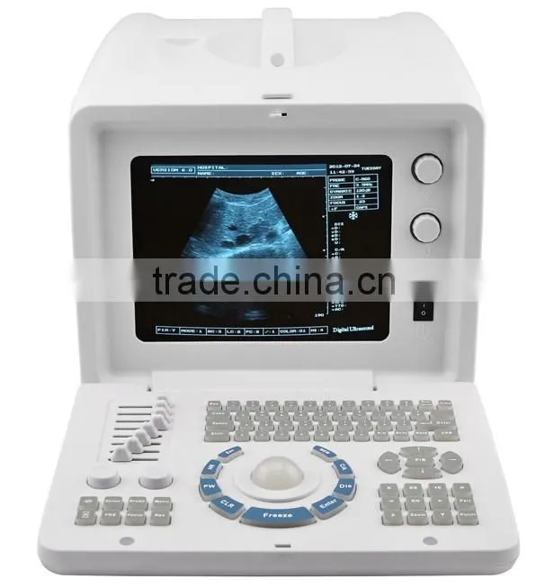 Good image Ultrasound Machine with linear transvaginal convex microconvex rectal probe