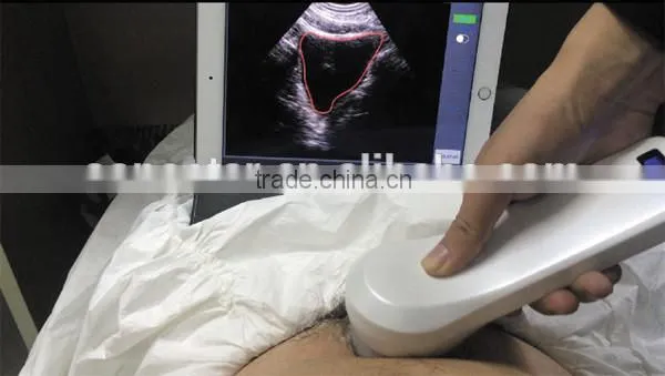 Sonostar new 3D 4D laptop ultrasound scanner ipad ultrasound scanner for sale BProbe-2