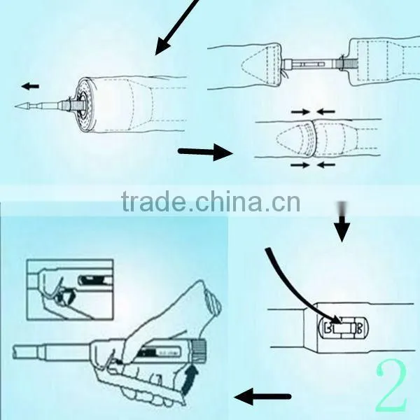 Disposable Alimentary Tract Stapler / Circular Stapler
