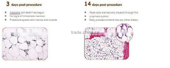 vacuum body shaper & skin cooler beauty equipment home use