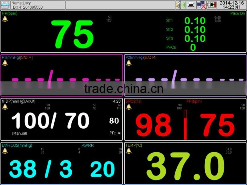 Patient vital signs monitor in recovery