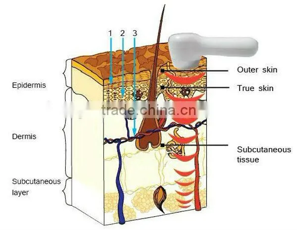 LW012 Best photon ultrasonic,ultrasonic face lift machine home use
