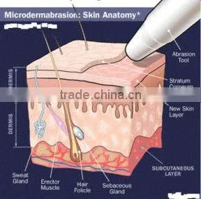 Mnaufacturer: 2014 RF and Cryo Meso Face Action Beauty salon Machine