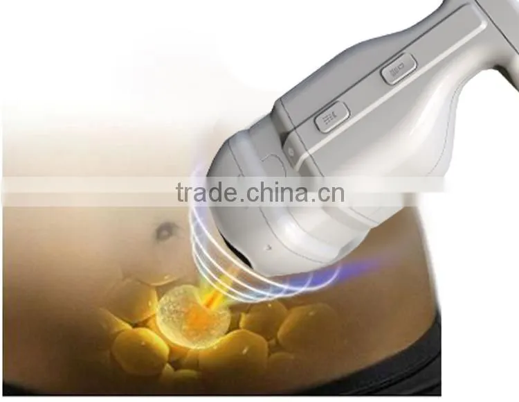 Professional hifu ultrasound body slimming lipo hifu device