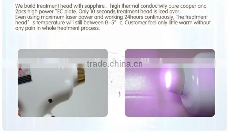 professional 808nm diode laser vertical hair removal beauty equipment