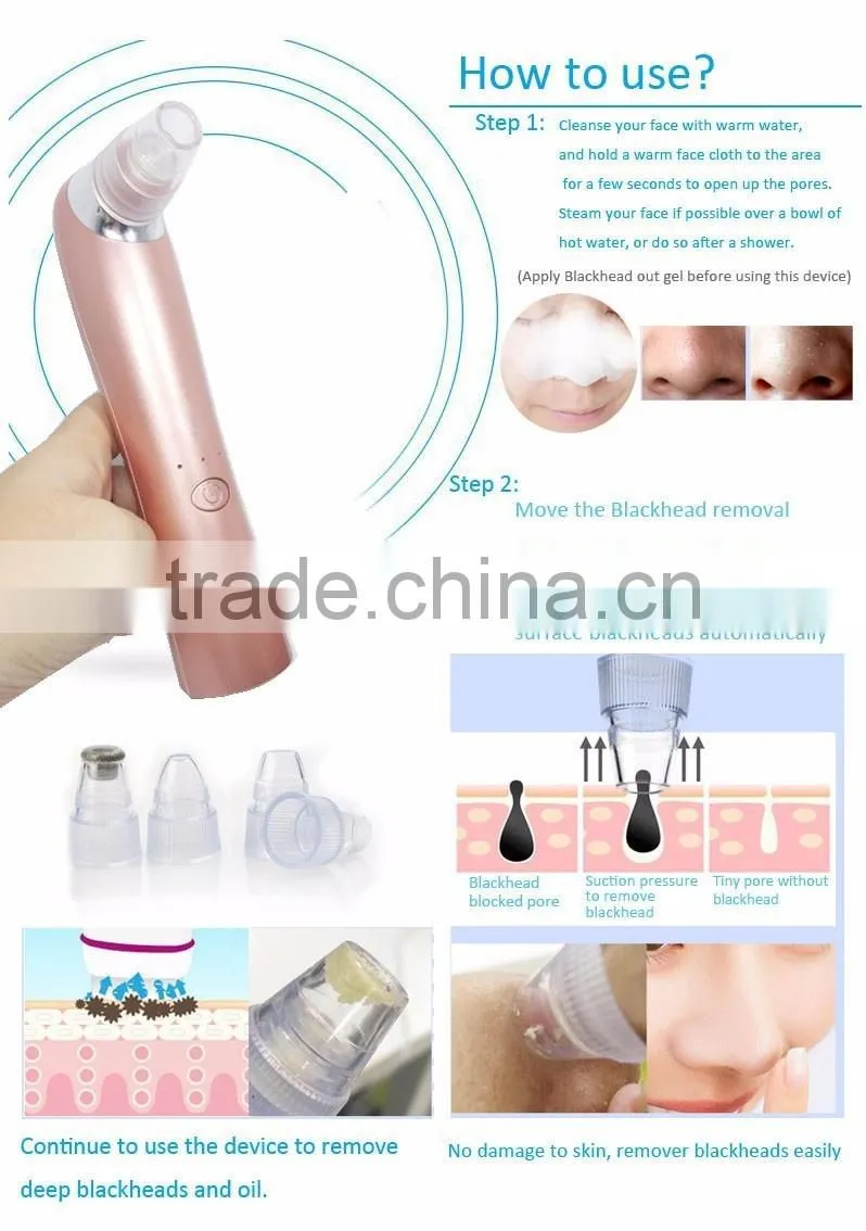 2017 Most Popular Blackhead Remover vacuum blackhead remover