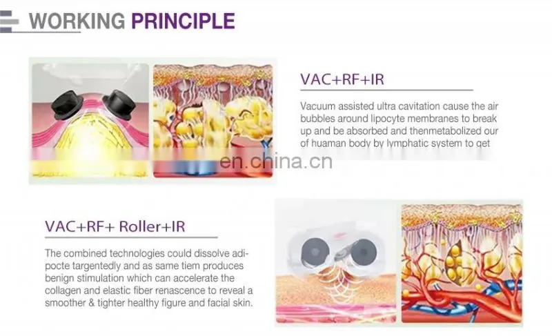 Multifunctional slimming device vacuum rf roller cellulite machine vela