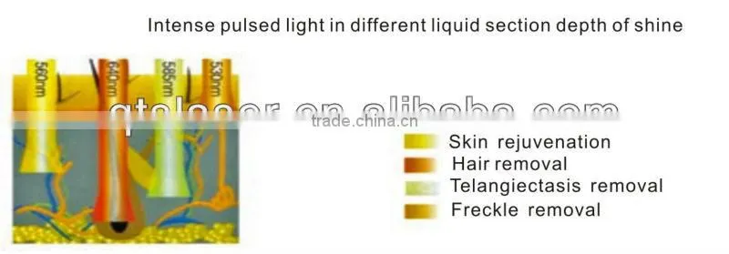 2013 Permanent hair removal machine photoderm ipl machine beauty care israel