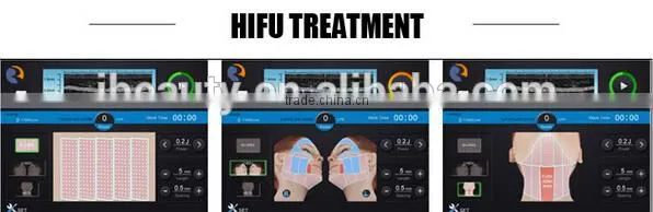 Instant Face Tighten And Face Lift Hifu Machine