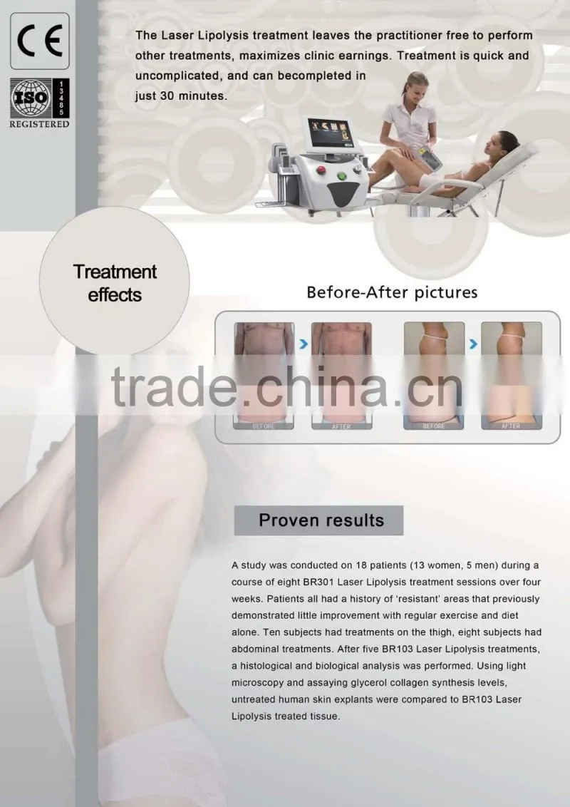Quick slim Lipolaser slimming machine / i lipo laser weight loss belly reduce / 650nm 980nm I LipoLaser