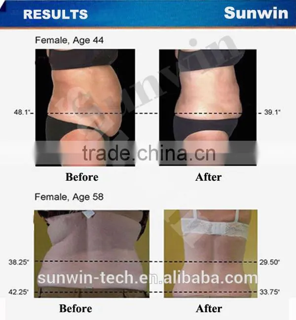 New Arrival!!!650nm diode laser slimming machine for sale!