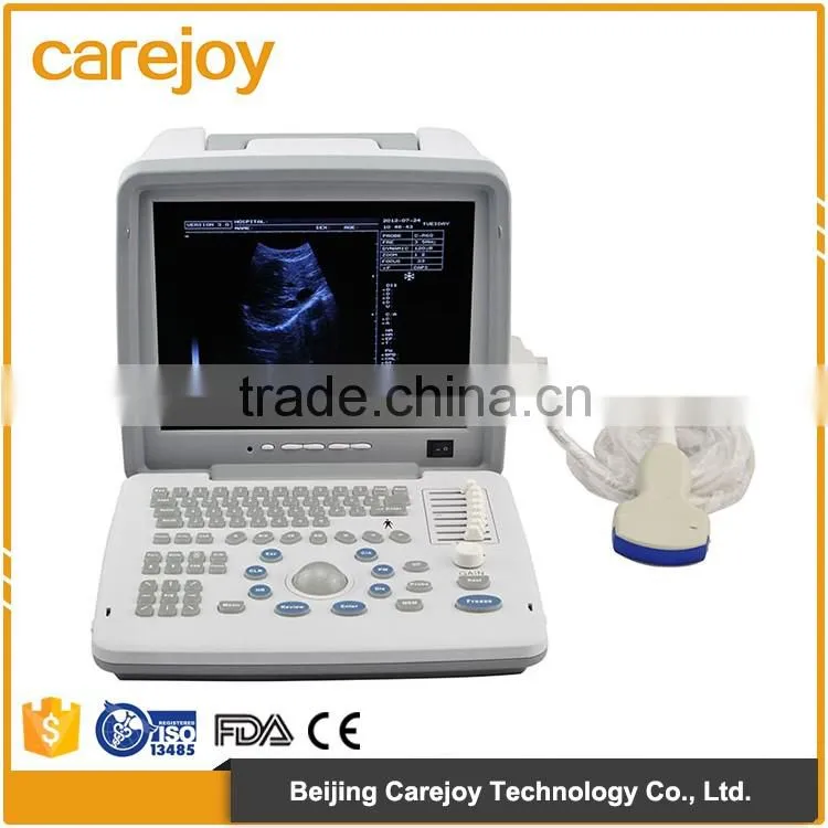 Medical hospital ultrasound diagnostic machine portable ultrasound equipment