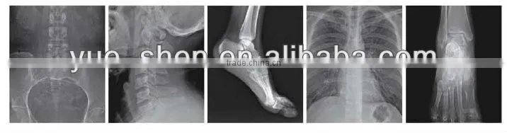 Medical 5KW high frequency mobile x-ray