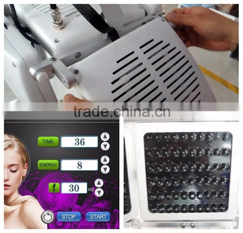 The Most Scientific 670nm laser hair regrowth machine with Japan Mitsubishi diode laser