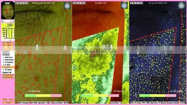 WT-03-S Super Trispectrum Magic mirror skin scanner analyzer