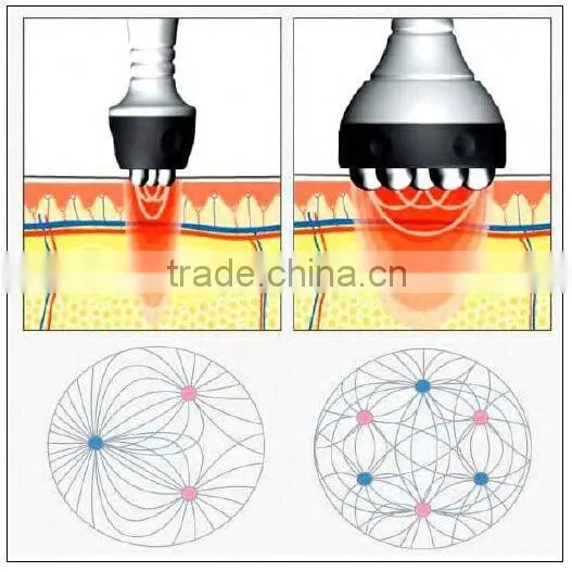 cavitation lipo ultrasound fat burning machine