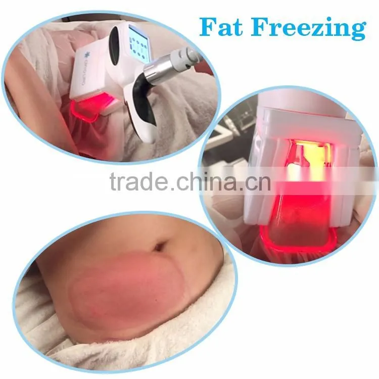 Perfect fast slimming cryotherapy equipment
