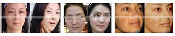 Wholesale home use 3 colors skin led face mask for skin rejuvenation