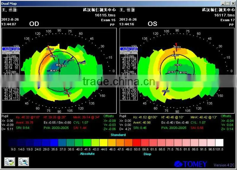 For low myopia MCT Technology high technology