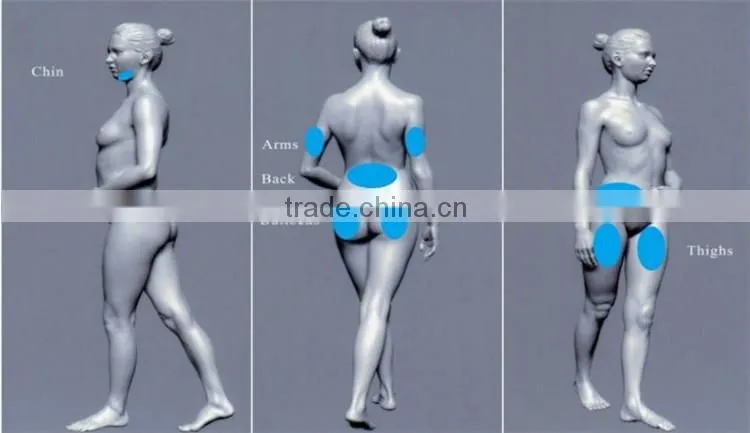 High Quality homeuse 650nm 4D Lipo laser with microcurrent slimming machine for fat loss and body shaping