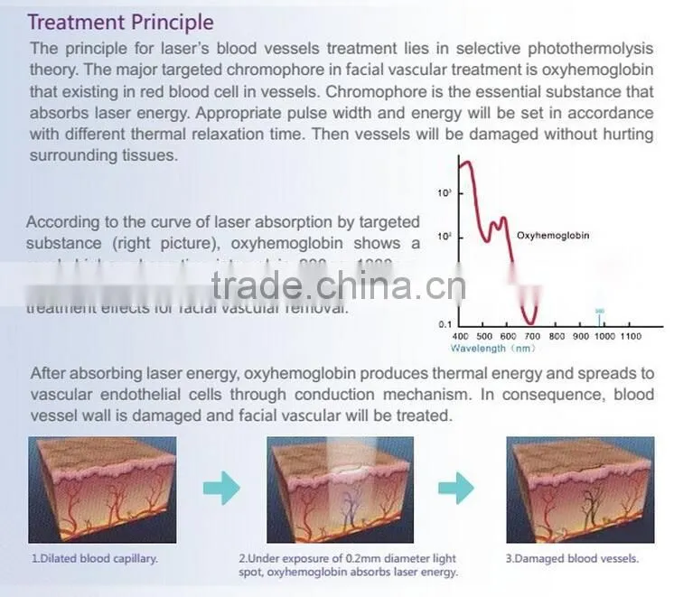 Diode laser 980nm vascular machine for spider vein removal