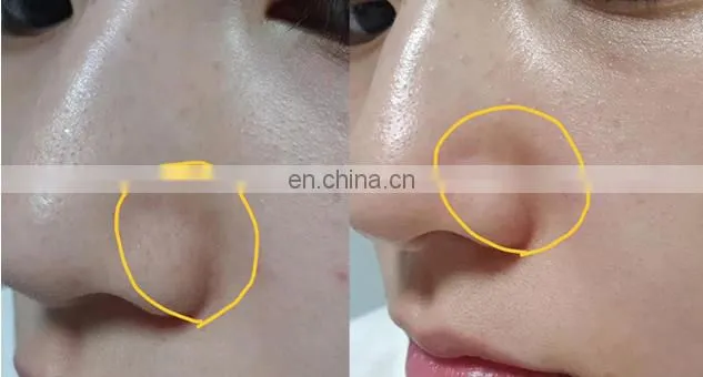 2019 New technology skin care 2 Handles facial beauty hydra dermabrasion oxygen spray machine