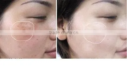 GTO brand 4 in1 Electroporation+ 1 M Ultrasonic+ Skin Scrubber+ HOT AND COLD THERAPY