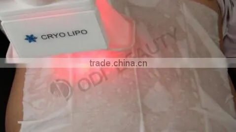 freezing fat cell slimming machine OD-C100 OEM body slimming belly fat loss fat freezing liposuction vibrating fat loss machine