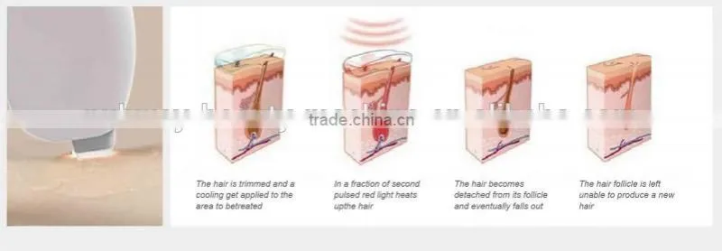 2015 permanent hair removal big power big spot size no pain home diode laser hair removal