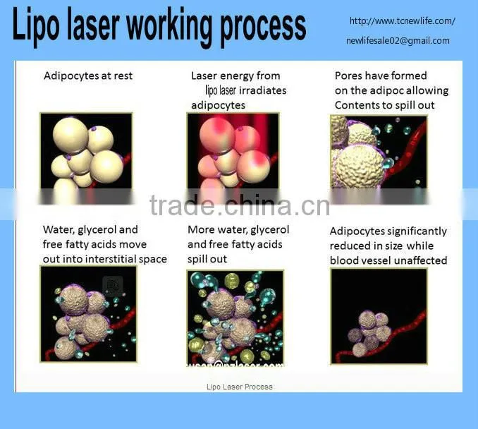 NL-LSR900 2015 Best!!! 4 in 1 rf laser slimming machine tripolar rf laser cavitation machine