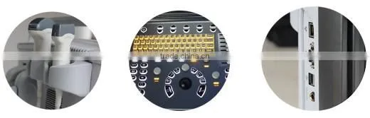 ECO2 high image quality good price black and white portable ultrasound Chison