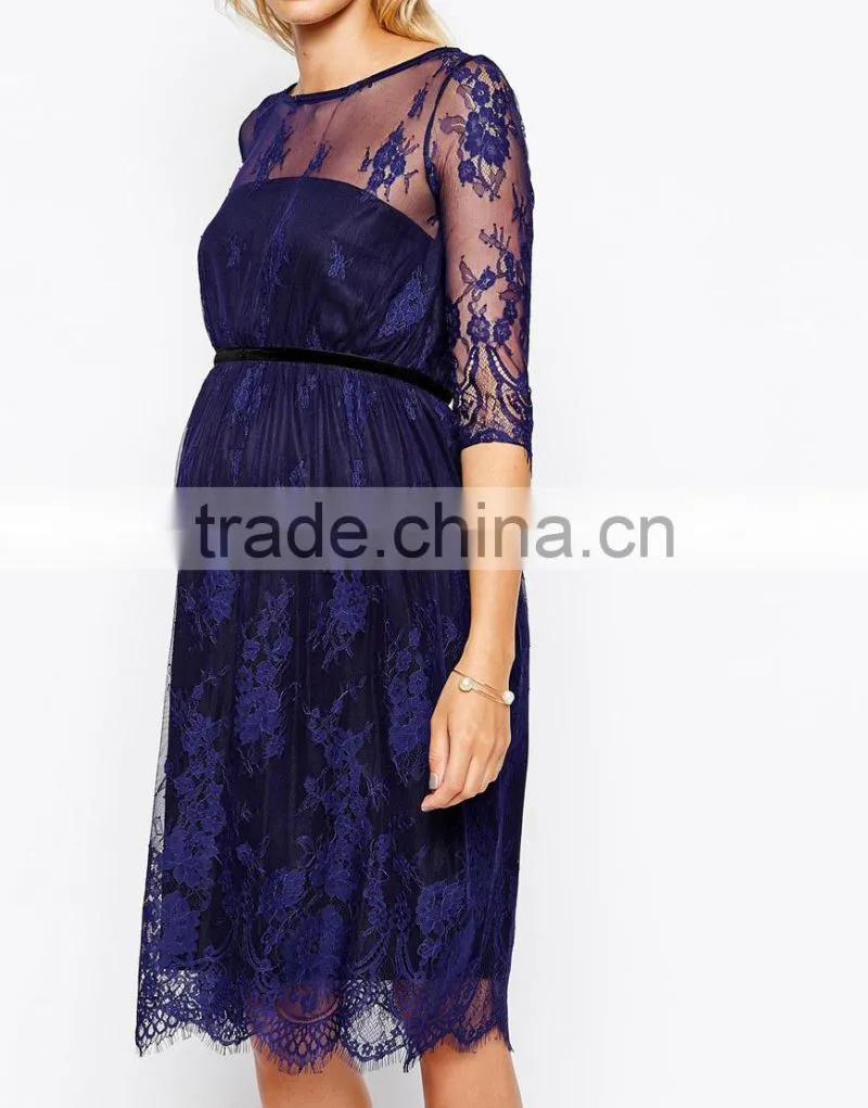 Maternity Lace Midi Dress With Scalloped Detail