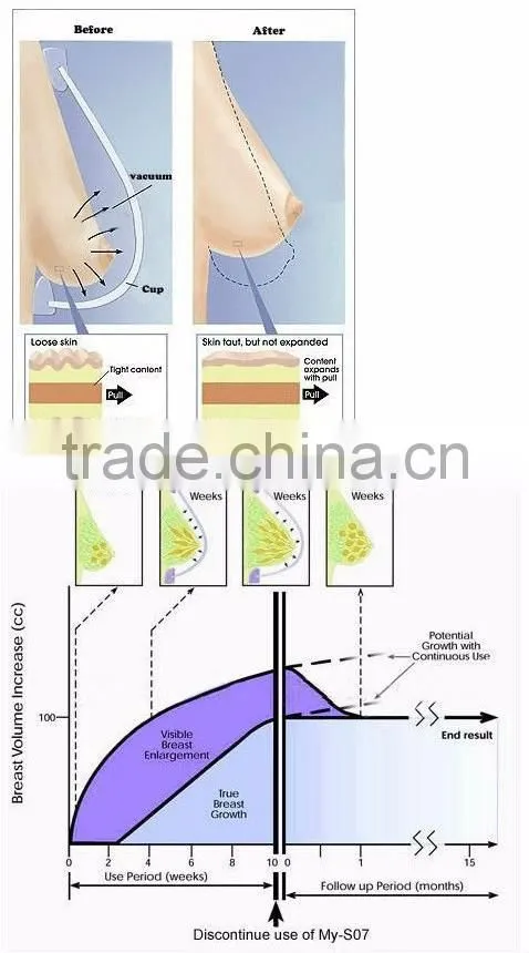 Home use body beauty breast enhancement breast care machine for personal use