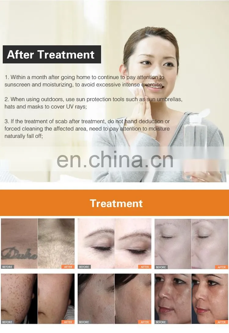 755nm Laser Pico Picosecond Laser Birthmark/ Tattoo Removal Skin Whitening Machine
