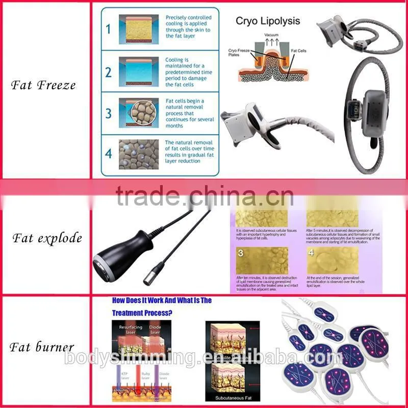 2014 New Laser Radio Frequency Ultrasonic Cavitation Venus Freeze Machine
