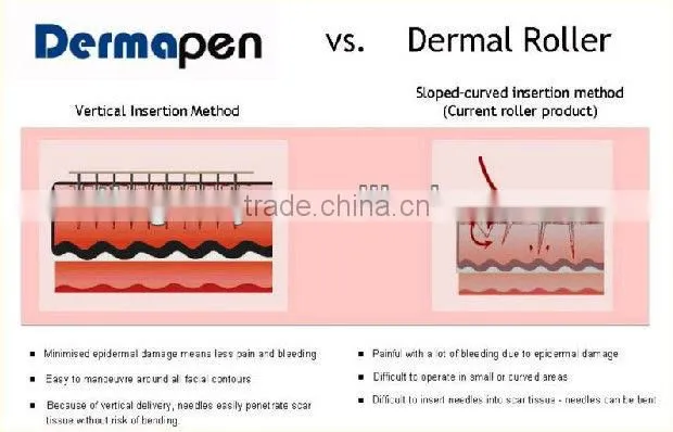 cheap germanium titanium facial roller tm-084