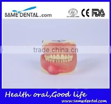 Dental Surgical Integrated Model Teaching Demonstration Teeth Model