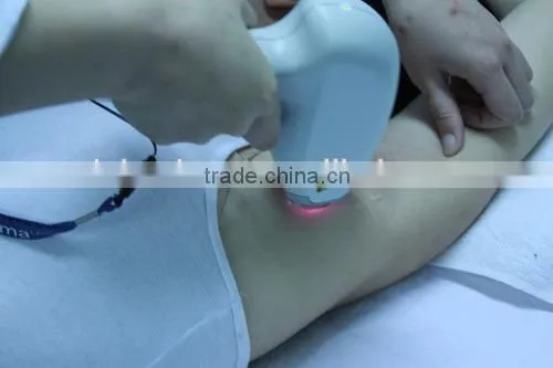 lady epilator hair removal face/good quality device for hair removal face
