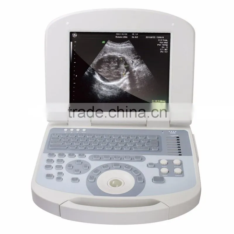 China medical human use ultrasound scanner portable laptop