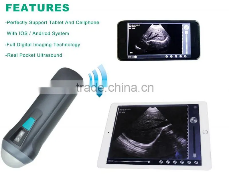 UProbe-1 Wireless Probe Ultrasound Scanner